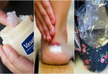 10 solutii pentru a preveni pantofii sa te jeneze