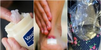 10 solutii pentru a preveni pantofii sa te jeneze