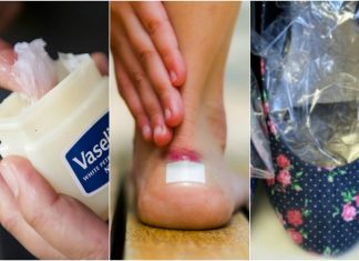 10 solutii pentru a preveni pantofii sa te jeneze
