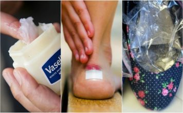 10 solutii pentru a preveni pantofii sa te jeneze