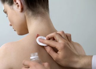 Cum sa vindeci o rana, astfel incat sa nu lase o cicatrice?